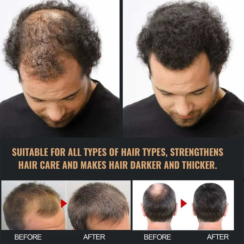 Anti Baldness Shampoo Thickening Shampoo Root Activator Shampoo Nourish Hair Regrowth Shampoo for Thinning Hair & Hair Loss