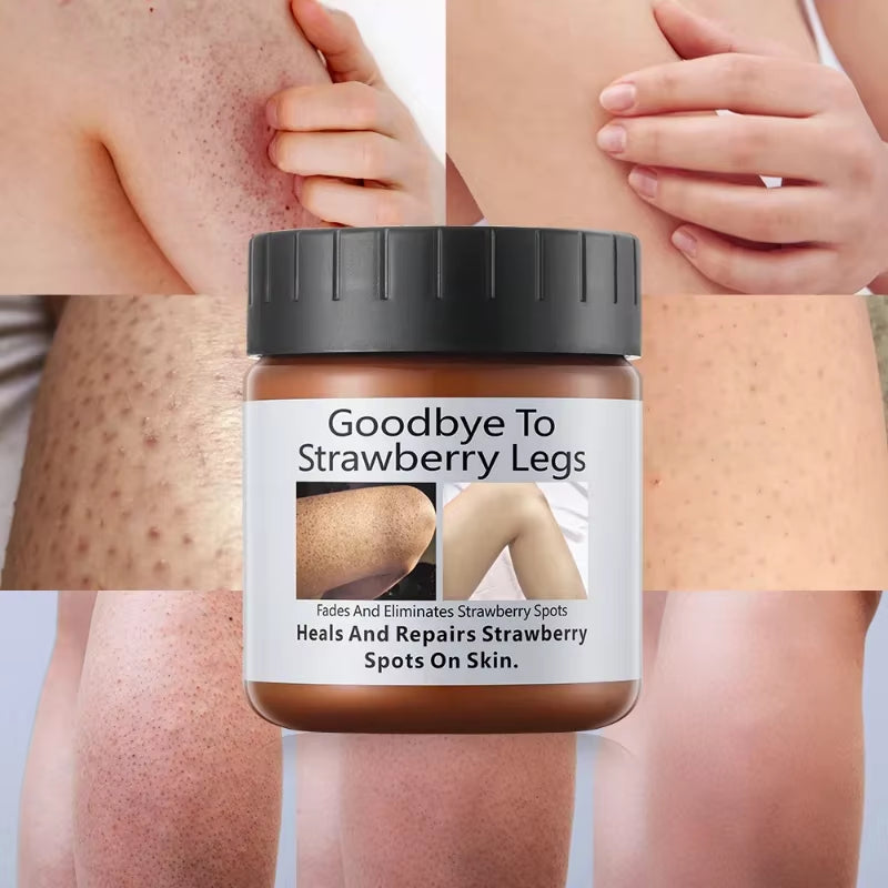 Goodbye to Strawberry Legs Cream Bump Eraser,Keratosis Pilaris,Moisturizing for Rough Bumpy Dry Skin for Body Smooth Hydrating