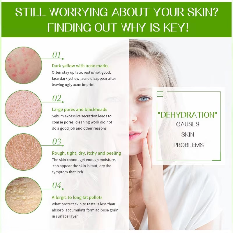 30Pcs Natural Aloe Vera Gel Face Mask Remove Acne Control Oil Depth Replenishment Moisturizing Wrapped Mask Shrink Pores