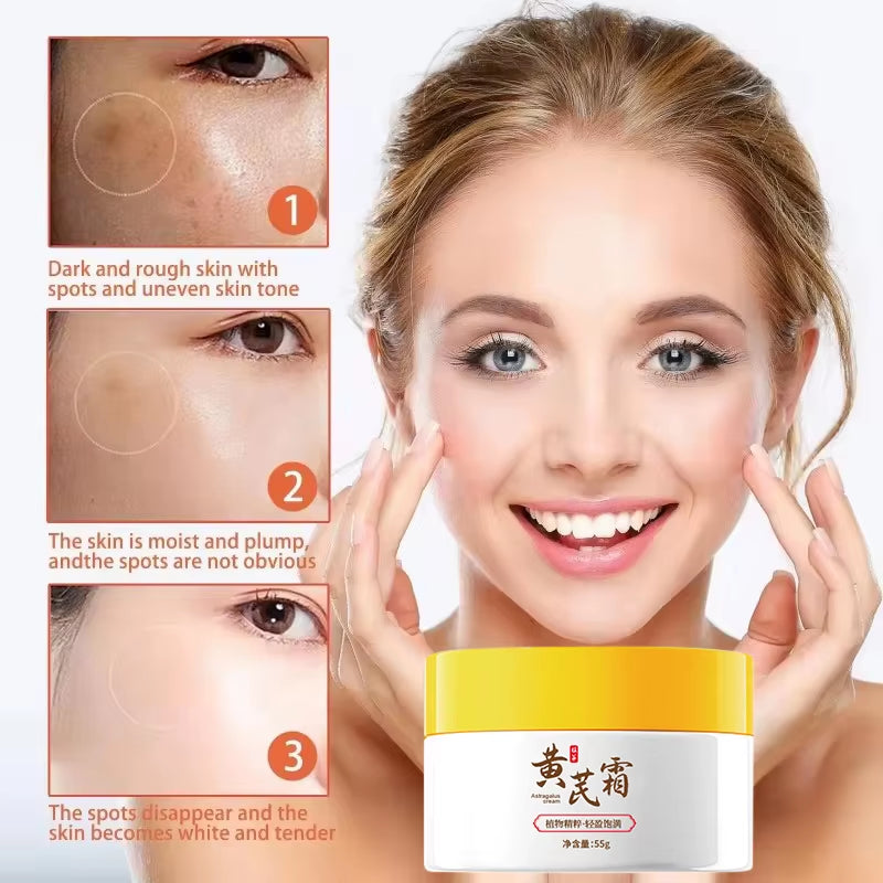 Astragalus Cream Brightening Face Care Moisturizing Cream Freckles Cream Face Dark Spots Remover Repair Removal Melasma Melanin