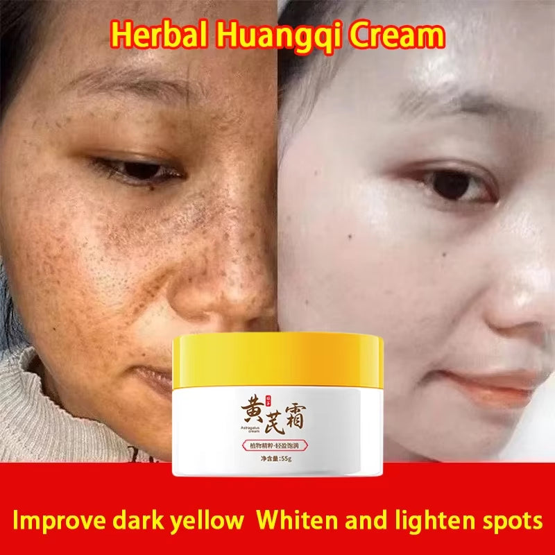 Astragalus Cream Brightening Face Care Moisturizing Cream Freckles Cream Face Dark Spots Remover Repair Removal Melasma Melanin