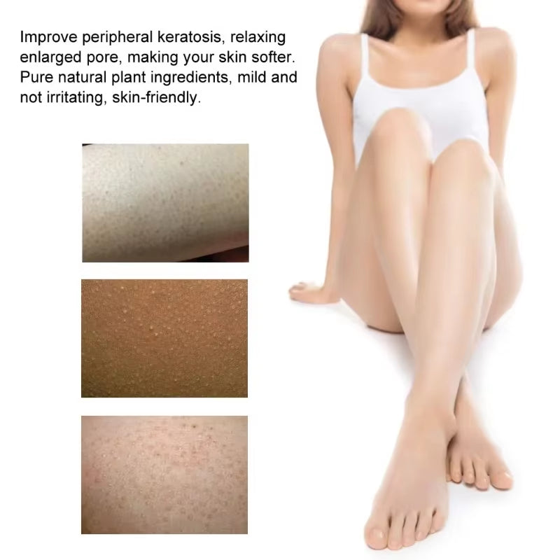 Goodbye to Strawberry Legs Cream Bump Eraser,Keratosis Pilaris,Moisturizing for Rough Bumpy Dry Skin for Body Smooth Hydrating